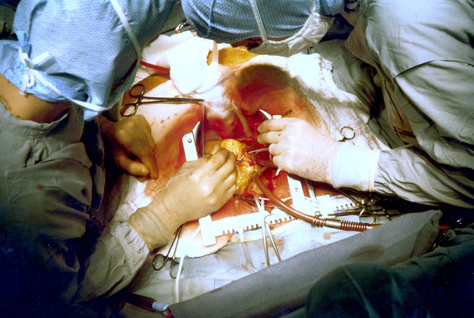 doctors doing open heart surgery
